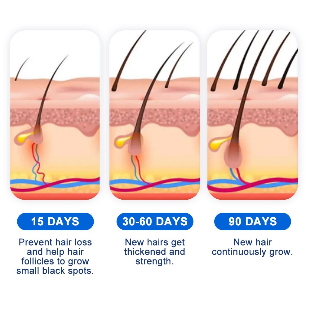Alopecia spray de crescimento  - Hair Care Growth avaliação e preço