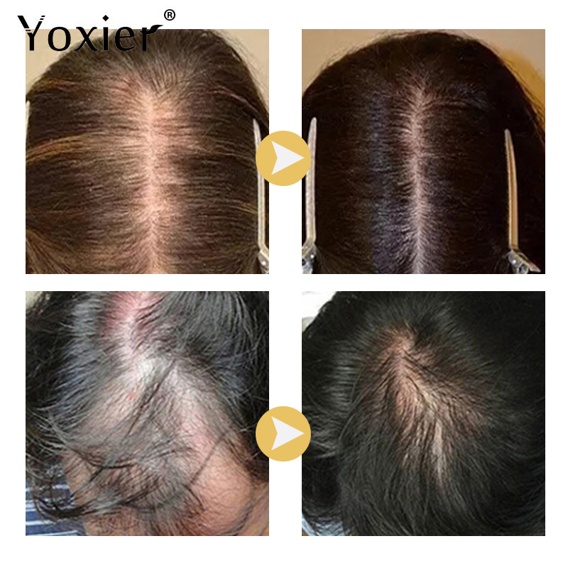 Soro de crescimento intensivo  - Hair Care Growth avaliação e preço