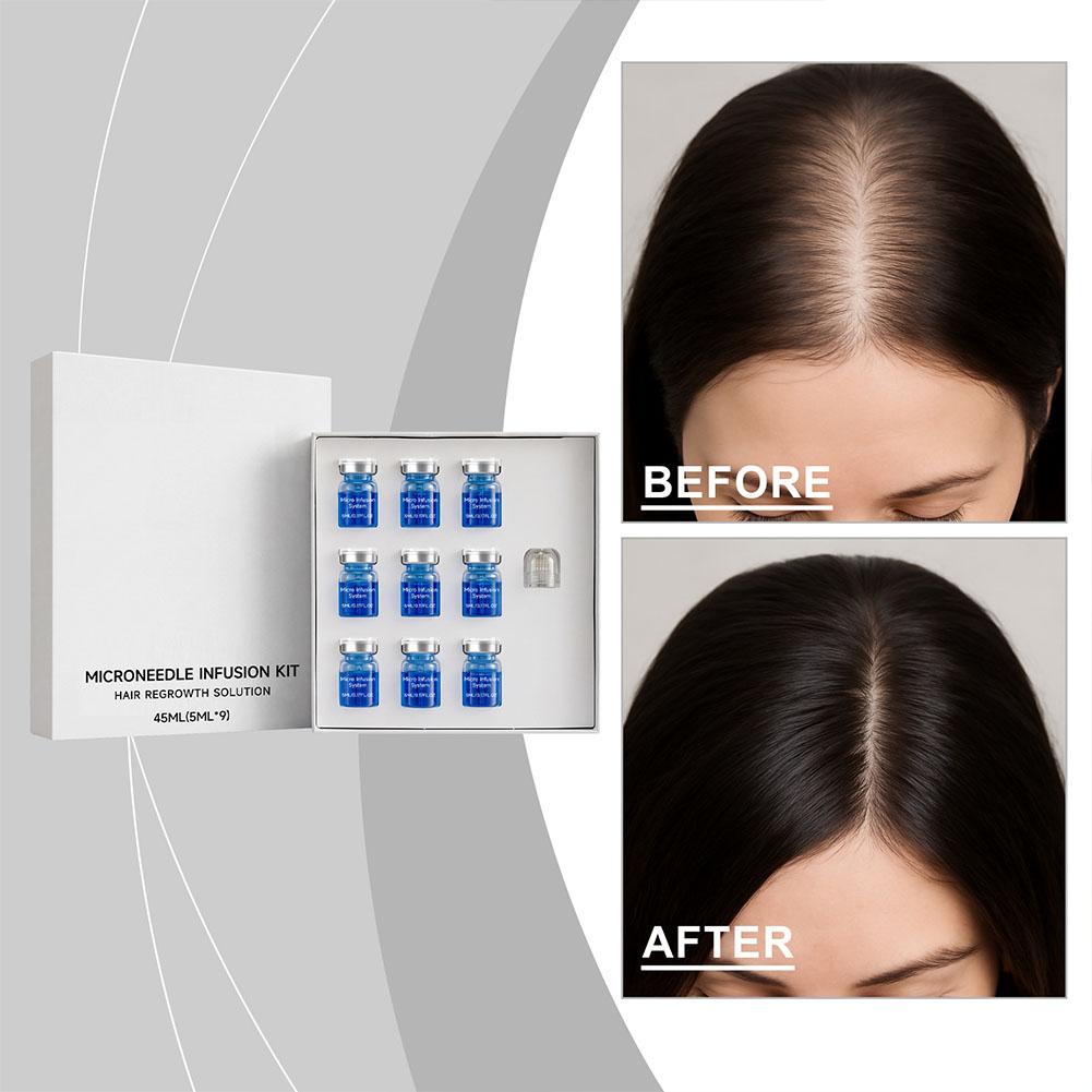 Kit de Rolo de Microagulhas co - Hair Care Routine avaliação e preço