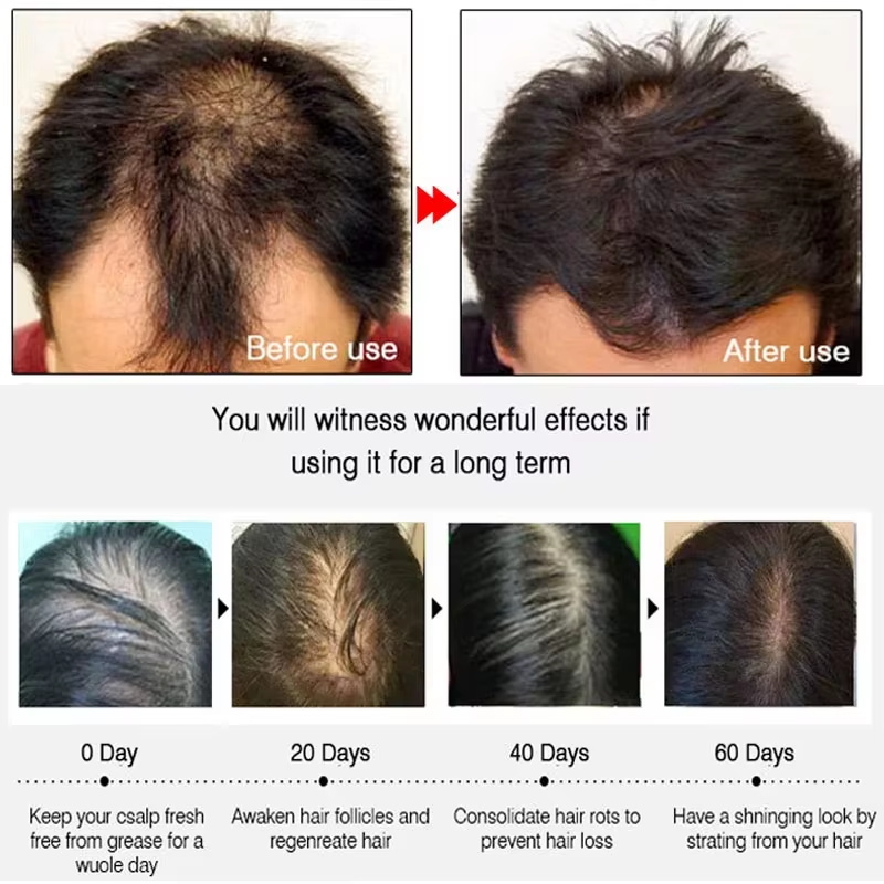 Spray de Crescimento Rápido de - Hair Care Growth avaliação e preço