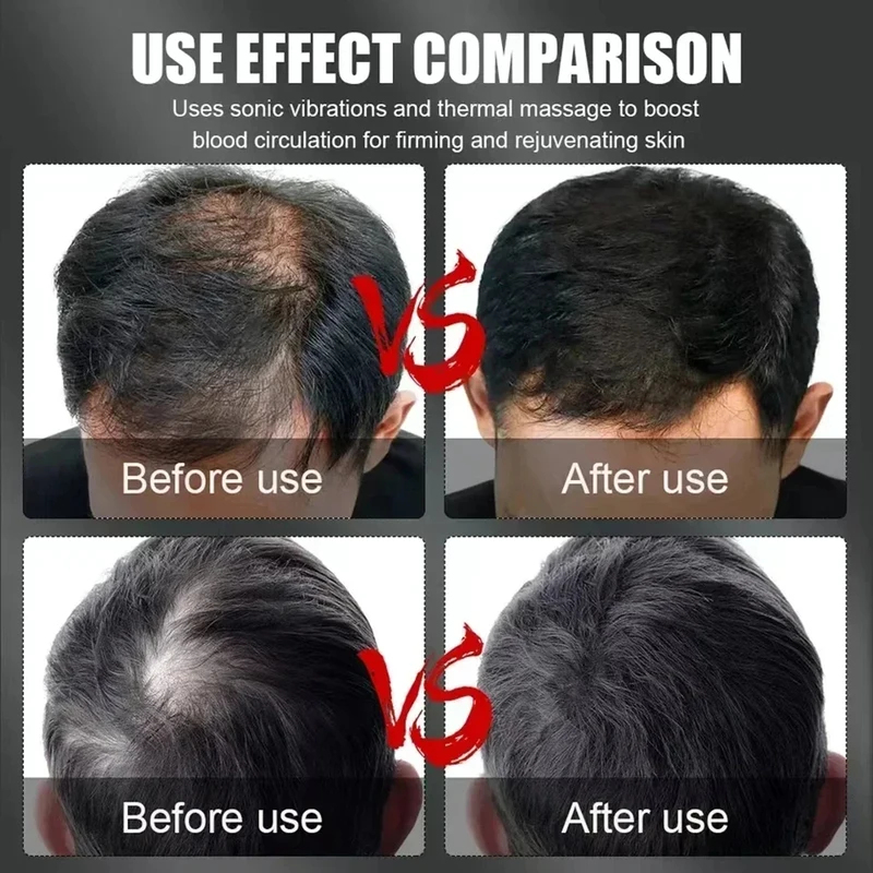 Boné Terapêutico de Luz Vermel - Hair Care Growth avaliação e preço